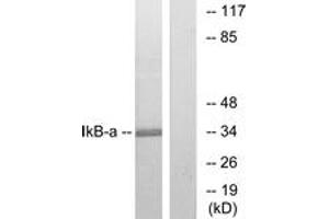 Western blot analysis of extracts from MCF7 cells, treated with TNF-alpha, using IkappaB-alpha (Ab-32/36) Antibody. (NFKBIA anticorps  (AA 15-64))