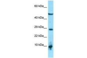 Image no. 1 for anti-All-Trans Retinoic Acid-Induced Differentiation Factor (ATRAID) (AA 182-231) antibody (ABIN6748383)