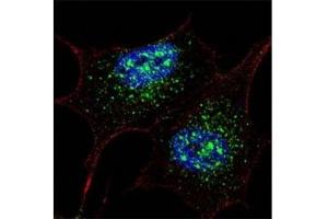 Fluorescent confocal image of SY5Y cells stained with NANOG antibody at 1:200. (Nanog anticorps  (AA 267-292))