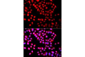 Immunofluorescence analysis of A549 cells using SETD6 antibody (ABIN6293801).