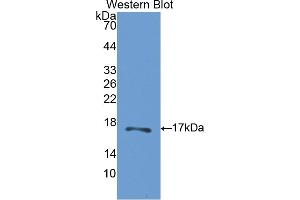 Western blot analysis of the recombinant protein. (CA5B anticorps  (AA 174-311))