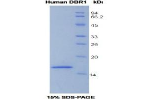 SDS-PAGE analysis of Human DBR1 Protein. (DBR1 Protéine)