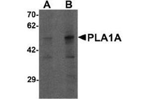 Western blot analysis of PLA1A in human kidney tissue lysate with PLA1A antibody at (A) 1 and (B) 2 ug/mL. (PLA1A anticorps  (C-Term))