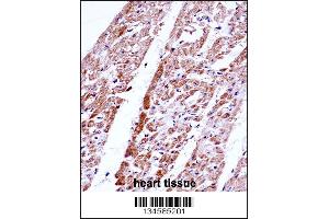 FST Antibody immunohistochemistry analysis in formalin fixed and paraffin embedded human heart tissue followed by peroxidase conjugation of the secondary antibody and DAB staining.