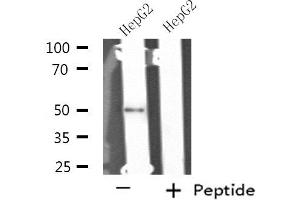 Western blot analysis of extracts from HepG2 cells using NIM1 antibody. (NIM1 anticorps  (C-Term))