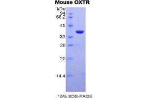 SDS-PAGE analysis of Mouse Oxytocin Receptor Protein. (Oxytocin Receptor Protein (OXTR))