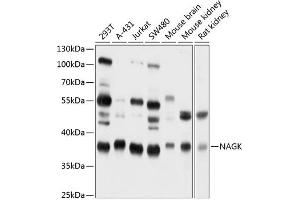 Western blot analysis of extracts of various cell lines, using NAGK antibody (ABIN6130569, ABIN6144344, ABIN6144345 and ABIN6224883) at 1:1000 dilution. (NAGK anticorps  (AA 50-210))