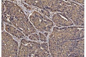 IHC analysis of PDIA6 using anti-PDIA6 antibody (ABIN7600554). (PDIA6 anticorps  (AA 20-440))