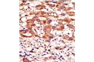 Image no. 2 for anti-Mannosyl (Alpha-1,3-)-Glycoprotein beta-1,2-N-Acetylglucosaminyltransferase (MGAT1) (N-Term) antibody (ABIN357694) (MGAT1 anticorps  (N-Term))
