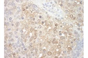 Immunohistochemistry (IHC) image for anti-Tuftelin Interacting Protein 11 (TFIP11) (AA 1-50) antibody (ABIN7448831) (TFIP11 anticorps  (AA 1-50))