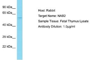 Host: Rabbit Target Name: NAB2 Sample Tissue: Human Fetal Thymus Antibody Dilution: 1ug/ml (NAB2 anticorps  (N-Term))