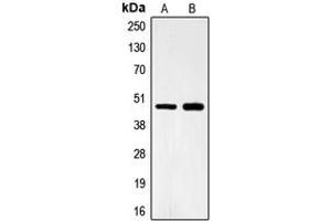 Western blot analysis of FOXB2 expression in Lovo (A), HeLa (B) whole cell lysates. (FOXB2 anticorps  (Center))