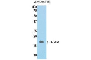 Western Blotting (WB) image for anti-Periostin (POSTN) (AA 500-630) antibody (ABIN1078431) (Periostin anticorps  (AA 500-630))