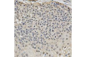 Immunohistochemistry (IHC) image for anti-Eukaryotic Translation Initiation Factor 4E (EIF4E) (AA 1-100) antibody (ABIN3023085)