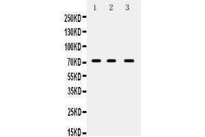 Anti- ABCG5 Picoband antibody, Western blotting All lanes: Anti ABCG5  at 0. (ABCG5 anticorps  (N-Term))