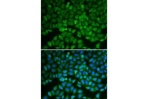 Immunofluorescence analysis of A549 cell using GSS antibody. (Glutathione Synthetase anticorps  (AA 1-474))