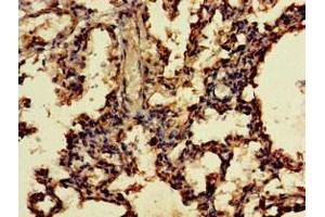 Immunohistochemistry of paraffin-embedded human lung tissue using ABIN7166249 at dilution of 1:100 (UNC13D anticorps  (AA 7-172))