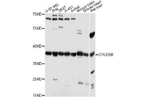 Western blot analysis of extracts of various cell lines, using OTUD6B antibody (ABIN6293808) at 1:3000 dilution. (OTUD6B anticorps)