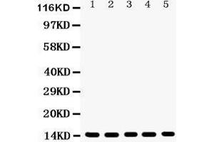 Anti- Profilin1 Picoband antibody, Western blotting All lanes: Anti Profilin1  at 0. (PFN1 anticorps  (C-Term))
