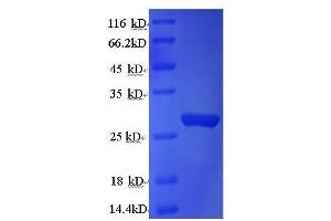 Cathepsin K (CTSK) (AA 115-329) protein (His tag) expressed in E.