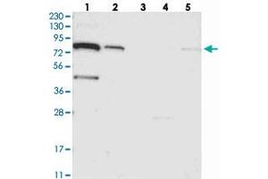 Western blot analysis of Lane 1: RT-4, Lane 2: U-251 MG, Lane 3: Human Plasma, Lane 4: Liver, Lane 5: Tonsil with SLC6A12 polyclonal antibody . (SLC6A12 anticorps)