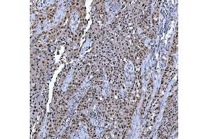 IHC analysis of TRMT6 using anti-TRMT6 antibody (ABIN7602138). (TRMT6 anticorps  (AA 6-489))