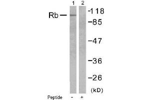 Image no. 1 for anti-Retinoblastoma 1 (RB1) (Ser795) antibody (ABIN197281) (Retinoblastoma 1 anticorps  (Ser795))