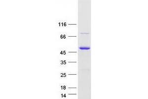 Validation with Western Blot