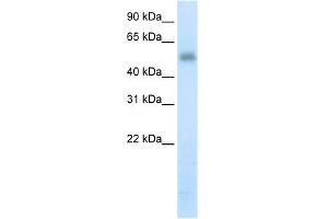 WB Suggested Anti-METTL3 Antibody Titration:  5. (METTL3 anticorps  (N-Term))