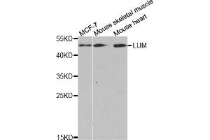 Western blot analysis of extracts of various cell lines, using LUM antibody (ABIN5973088) at 1/1000 dilution. (LTBR anticorps)
