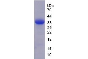 SDS-PAGE of Protein Standard from the Kit  (Highly purified E. (Granulin Kit ELISA)