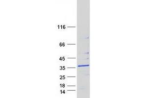 Validation with Western Blot