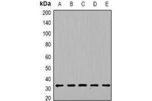 Western blot analysis of DGUOK expression in HepG2 (A), mouse heart (B), mouse kidney (C), rat liver (D), rat brain (E) whole cell lysates.