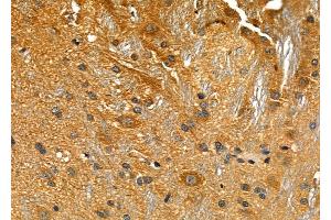 ABIN6258175 and ABIN6276034 at 1/100 staining Rat brain tissue by IHC-P. (GPR34 anticorps  (C-Term))