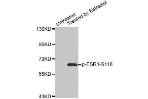 Western blot analysis of extracts from MDA cells using Phospho-ESR1-S118 antibody (ABIN2987431). (Estrogen Receptor alpha anticorps  (pSer118))