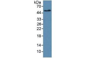 WB of Protein Standard: different control antibodies  against Highly purified E. (ErbB2/Her2 Kit ELISA)