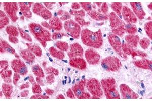 Anti-Endothelin A Receptor antibody  ABIN1048556 IHC staining of human heart, cardiac myocytes.