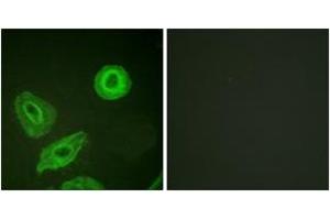 Immunofluorescence analysis of HeLa cells, using HER3 (Phospho-Tyr1289) Antibody. (ERBB3 anticorps  (pTyr1289))