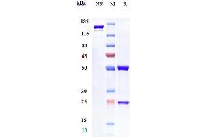 Anti-IFNAR1 Reference Antibody (anifrolumab) on SDS-PAGE under reducing (R) condition. (Recombinant IFNAR1 (Anifrolumab Biosimilar) anticorps)