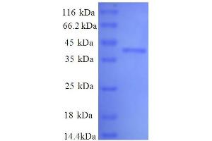 Lactate Dehydrogenase A (LDHA) (AA 5-323), (partial) protein (His tag) (Lactate Dehydrogenase A Protein (LDHA) (AA 5-323, partial) (His tag))