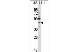 NEUROD6 Antibody (N-term ) (ABIN657404 and ABIN2846444) western blot analysis in ZR-75-1 cell line lysates (35 μg/lane). (NEUROD6 anticorps  (N-Term))