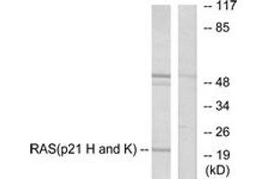 Western blot analysis of extracts from HeLa cells, using RASH/RASK Antibody. (RASH/RASK (AA 1-50) anticorps)