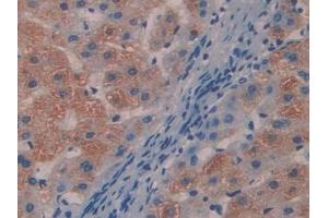 DAB staining on IHC-P; Samples: Human Liver Tissue