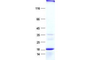 Validation with Western Blot