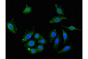 Immunofluorescent analysis of A549 cells using ABIN7149934 at dilution of 1:100 and Alexa Fluor 488-congugated AffiniPure Goat Anti-Rabbit IgG(H+L) (DPYSL4 anticorps  (AA 280-560))