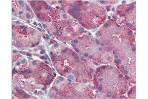 Immunohistochemical staining of Stomach using AP31138PU-N ERP44 antibody (ERP44 anticorps  (C-Term))