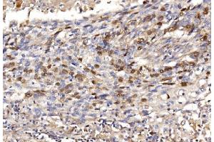 IHC analysis of Geminin/GMNN using anti-Geminin/GMNN antibody (ABIN7600598). (Geminin anticorps  (AA 21-196))