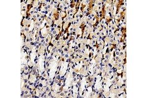 Immunohistochemistry of paraffin embedded rat stomach using ANXA3 (ABIN7073065) at dilution of 1: 300 (400x lens)
