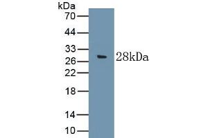 Detection of Recombinant C9, Rat using Polyclonal Antibody to Complement Component 9 (C9) (C9 anticorps  (AA 336-554))