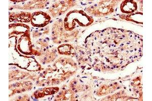 Immunohistochemistry of paraffin-embedded human kidney tissue using ABIN7143307 at dilution of 1:100